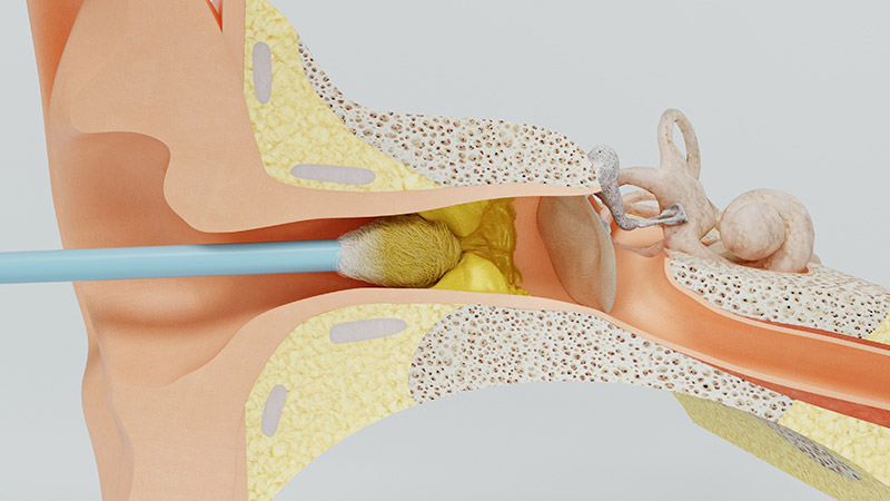 medical-surgical-conditions-of-the-ear-castle-rock-co-castle-rock